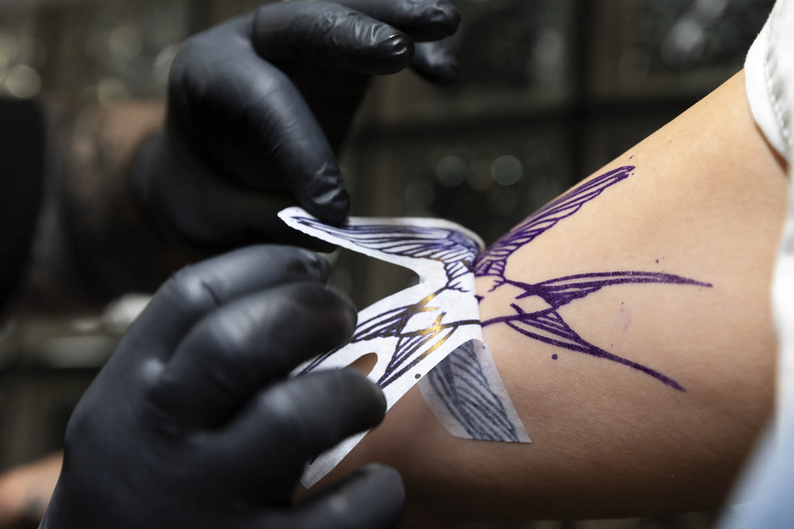 como remover tatuagem caseiro