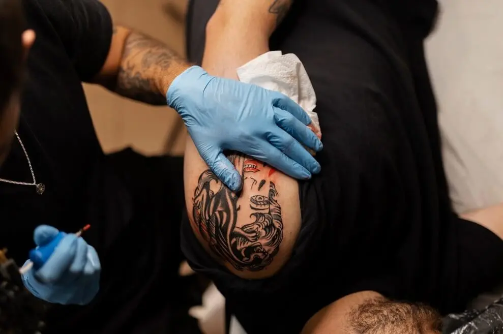 como tirar tatuagem